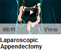 Laparoscopic Appendectomy